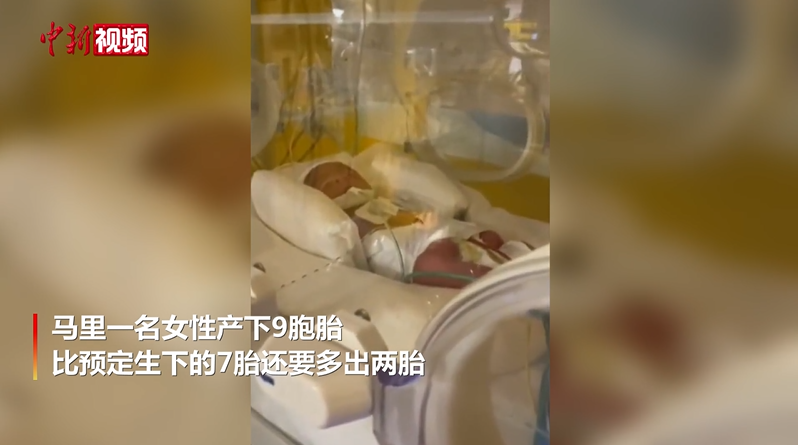 9胞胎!非洲妈妈一胎生下5女4男