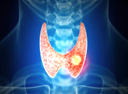 结节、息肉、囊肿，体检查出的这些“小肿物”会发展成癌吗？