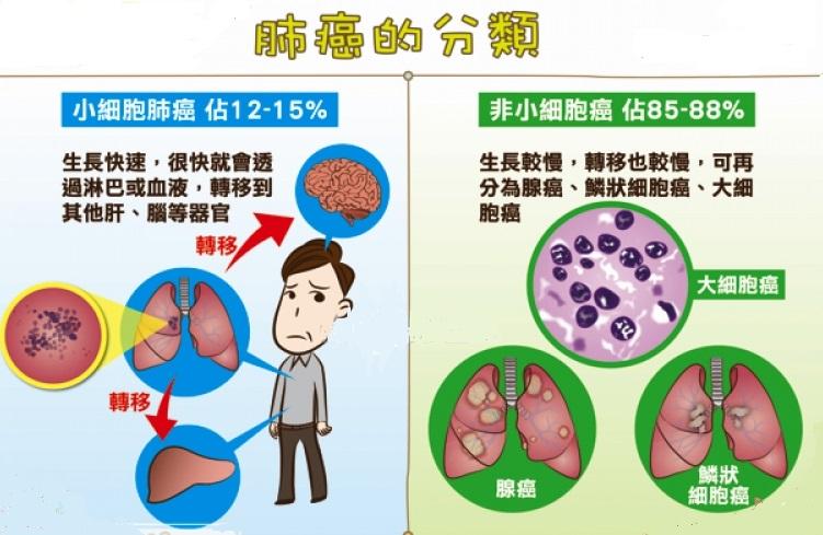 肺癌种类图片