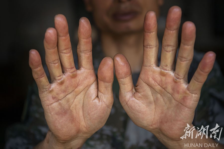 7月22日,战略支援部队某大队,高玉华的手上布满硬邦邦的茧子.
