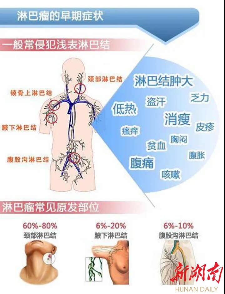 【9.15世界淋巴瘤宣传日】关于淋巴瘤,您想了解的都在这里