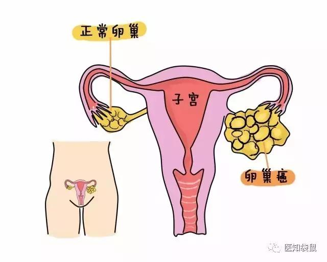 子宫卵巢附件图片大全图片