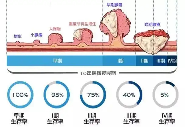 胃癌存活率图片