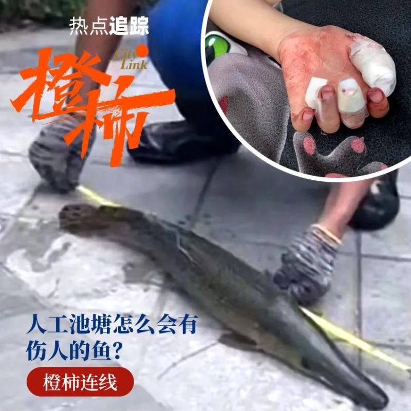 江苏男孩手被近1米长怪鱼咬得鲜血淋漓！这种鱼哪来的？卵还有毒