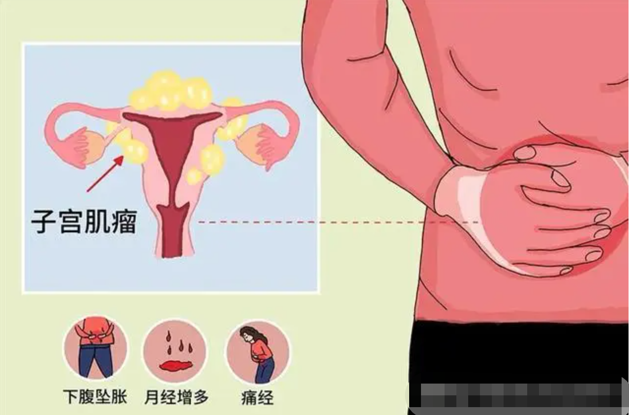 花季少女的"尴尬青春",原来是它惹的祸-新湖南