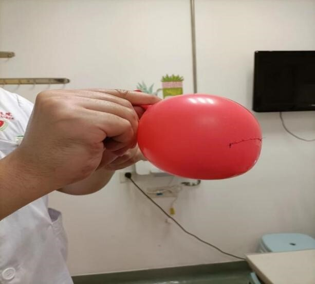 显微镜下给气球做“缝合手术”，还能吹起来！这位湖南医生得了全国大奖
