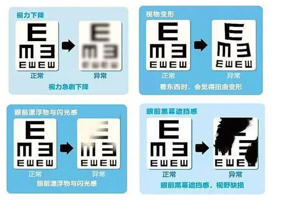 眼前“飞蚊”环绕、黑影在飘?警惕视网膜脱离 - 株洲 - 新湖南