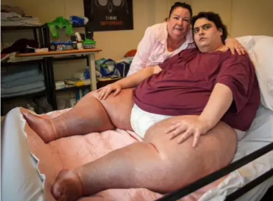 英国最胖男子因器官衰竭去世 体重超600斤