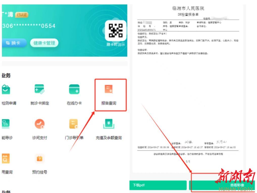 怎么安装DR胶片医院“照片”不给胶片了？患者：点赞！_https://www.jmylbn.com_新闻资讯_第1张