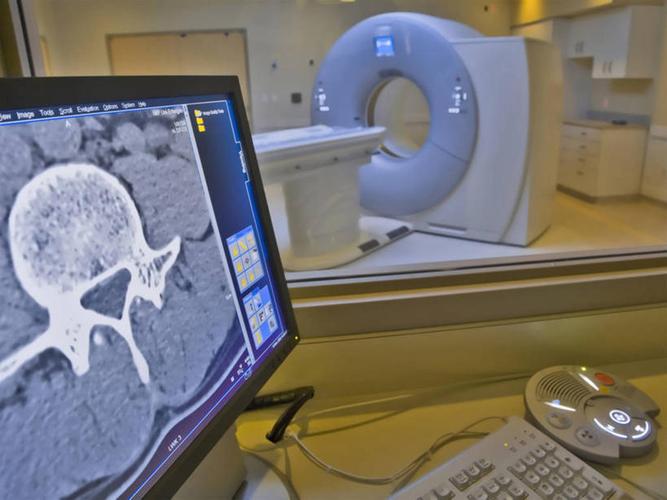 AI只需X射线片即可判断肺功能
