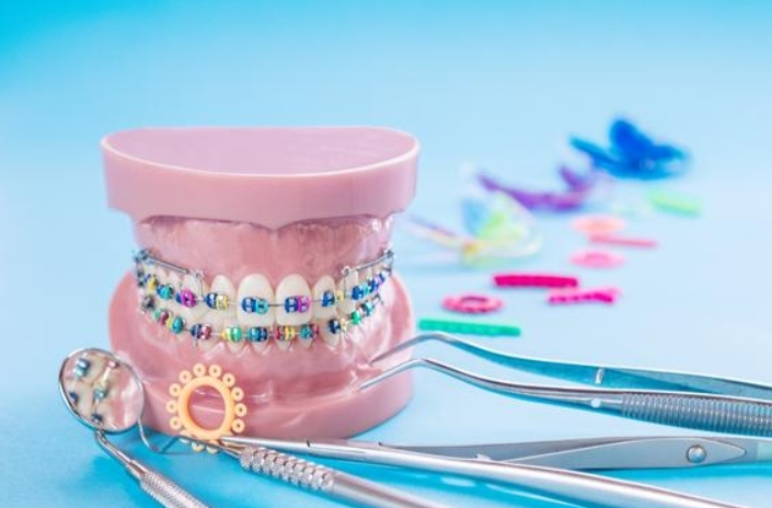 整牙要趁早？——低龄儿童整牙热调查