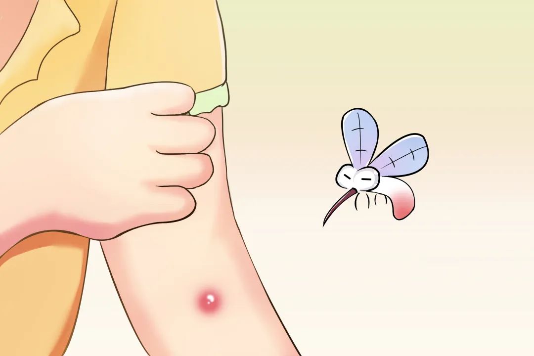蚊叮虫咬后的“红疙瘩”，这样处理好得快 | 科普时间