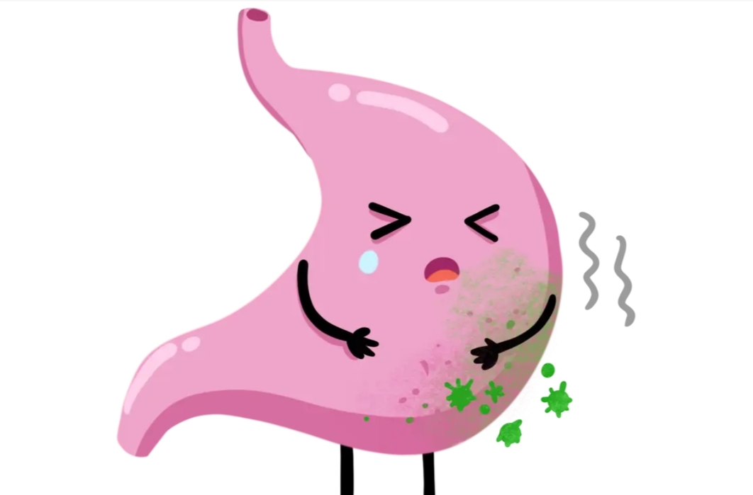 周末·健康丨常吃这类食物，感染幽门螺杆菌概率大大增加
