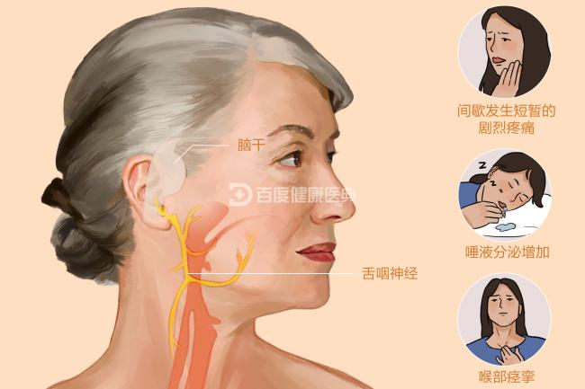 一吃东西就喉咙痛，不一定是咽喉炎！