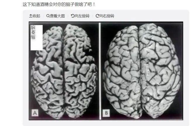 假日·健康丨这2种饮品混在一起，伤害大脑！假期聚会别这样喝