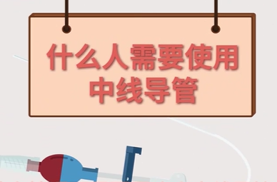 一见“中”情  连“线”健康--中线导管患教手册