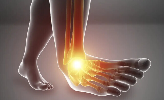 别拿崴脚不当事，警惕踝关节韧带损伤