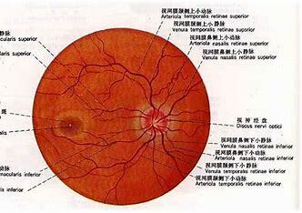 视网膜血管“指纹”可预测中风风险