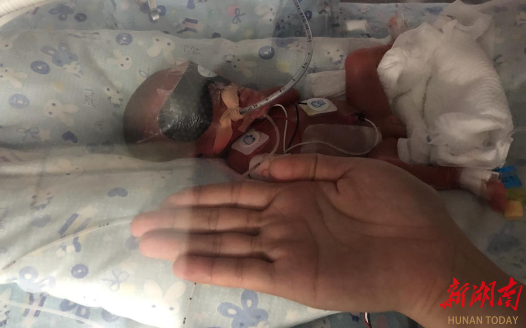 明明是双胞胎，出生时间竟然差3天？超早产姐妹花历经生死闯关终团圆