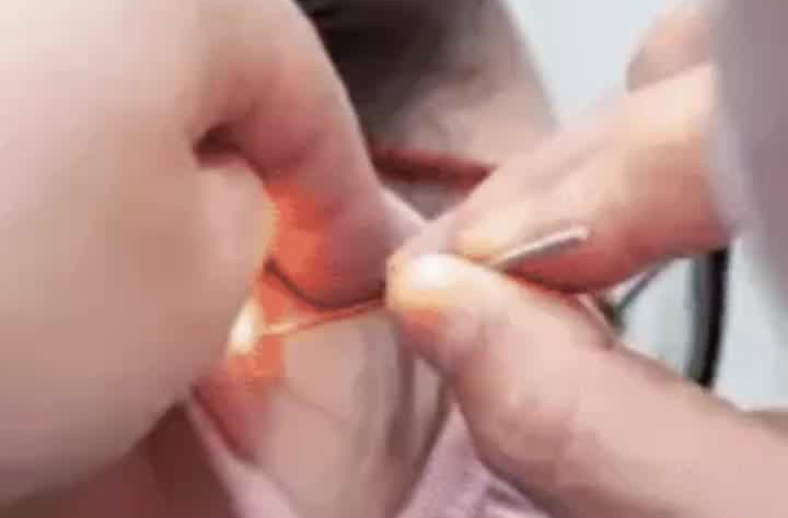  这些生活习惯伤听力，保护听力中医有方法