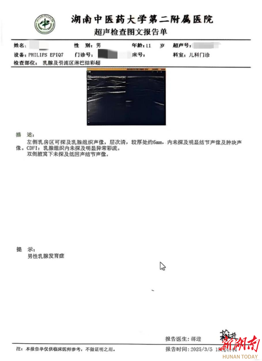 11歲男孩“胸痛” 竟是乳房異常發(fā)育