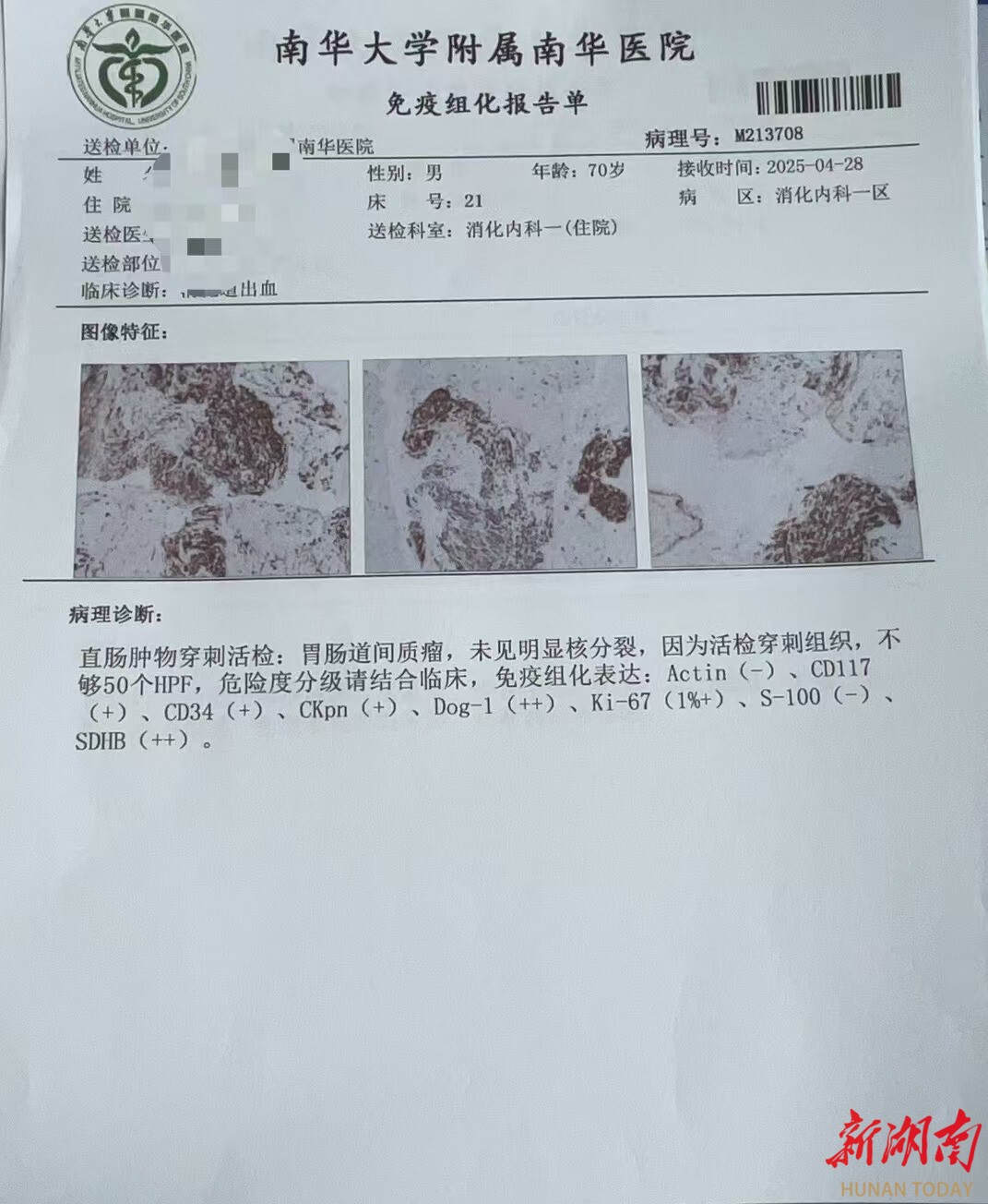 南华医院消化内科精准诊断再突破：超声内镜引导下细针穿刺助力直肠间质瘤微创诊疗