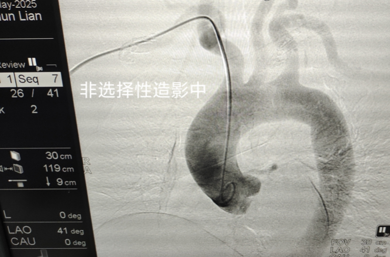 云上会诊 省县协作，江永成功救治复杂急性心梗患者