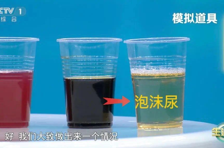 周末·健康丨喝水后4个异常 可能是肾发出的“求救信号”