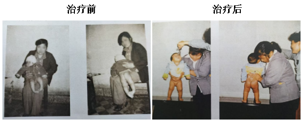 跨越36年的生命信任——湘潭市中医医院中医矫形托起两代人健康
