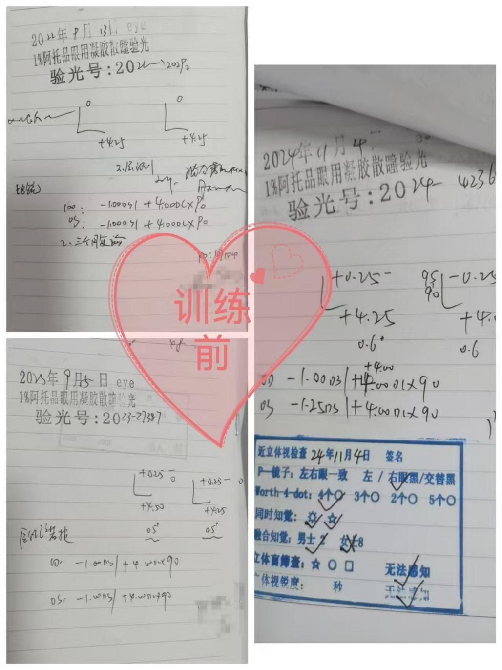从0.6到1.2！陪6岁女儿战胜弱视100天！——来自一位妈妈的就诊回忆录