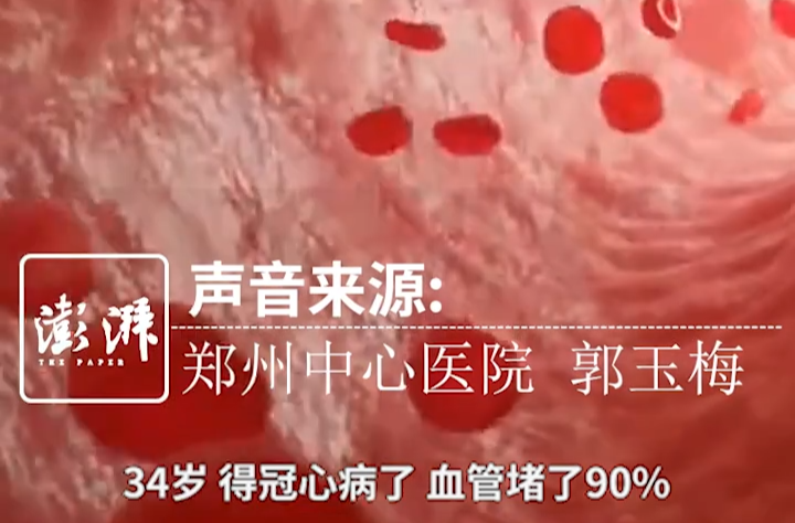 34岁女子爱生闷气，一根血管竟堵塞90%