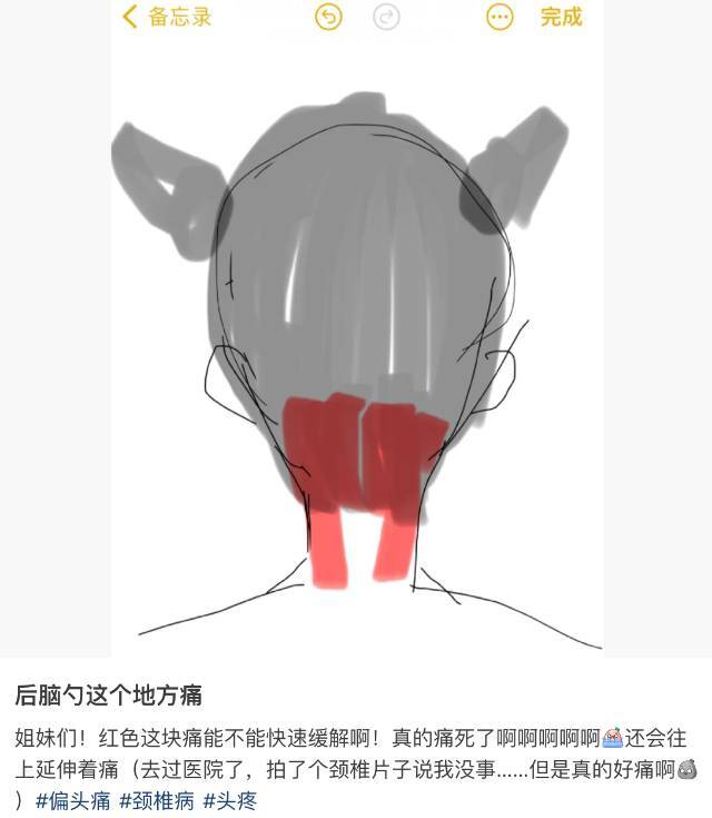 周末·健康丨后腦勺下方疼不是偏頭痛 這些小動(dòng)作能緩解→ 