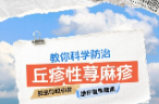 蚊蟲叮咬引發(fā)丘疹性蕁麻疹？科學(xué)防治看這里→