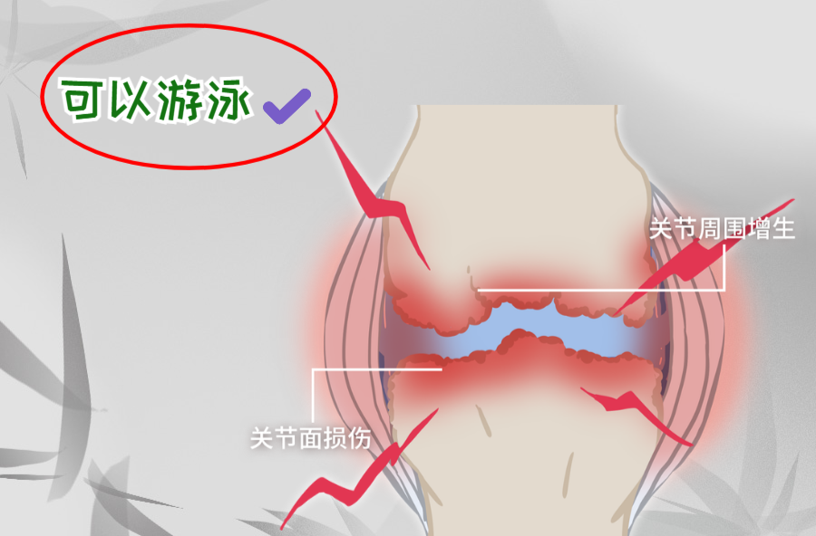 文萃新知｜養(yǎng)護骨關(guān)節(jié)，優(yōu)選水中運動