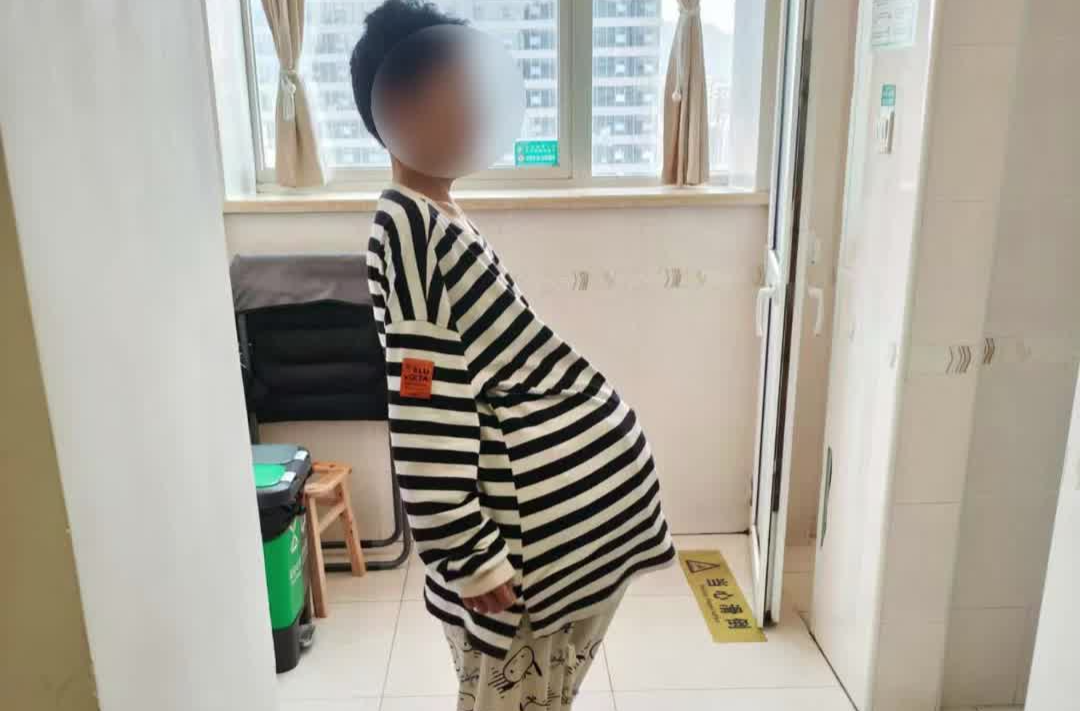 湖南一女子盆腹腔長(zhǎng)了38斤腫瘤，3個(gè)醫(yī)生一起從其體內(nèi)“抬出”
