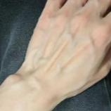 周末·科普丨為什么有的人手上青筋暴起？這些地方出現(xiàn)青筋，一定要小心