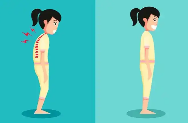 孩子“高低肩”“剃刀背”？小心是脊柱侧弯