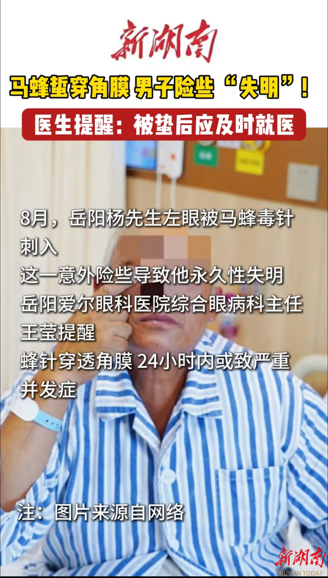 马蜂蜇穿角膜 男子险些 “失明”！