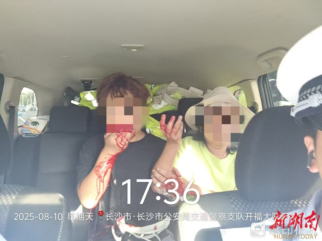 男子术后外出口鼻流血不止！交警紧急救助送医