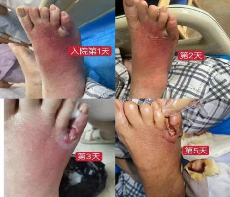 從指尖到心尖的故事|在潰爛的傷口里種春天