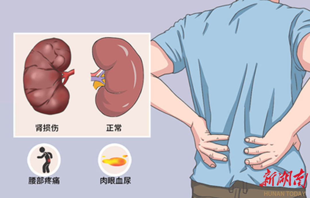 “全年无休”的肾脏，该如何保持健康？
