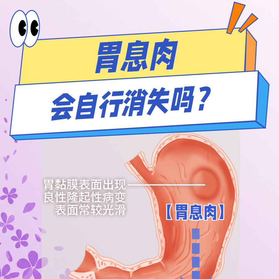30岁女演员自曝“胃里切了8个息肉” 医生提醒：这种胃息肉要警惕
