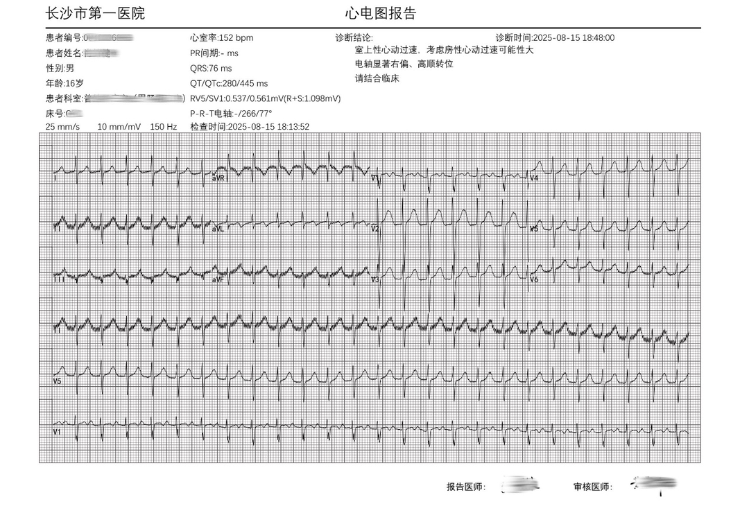 突破传统手术禁区，长沙市第一医院电生理团队利用脉冲电场消融术治疗少年左心耳尖部“房速”