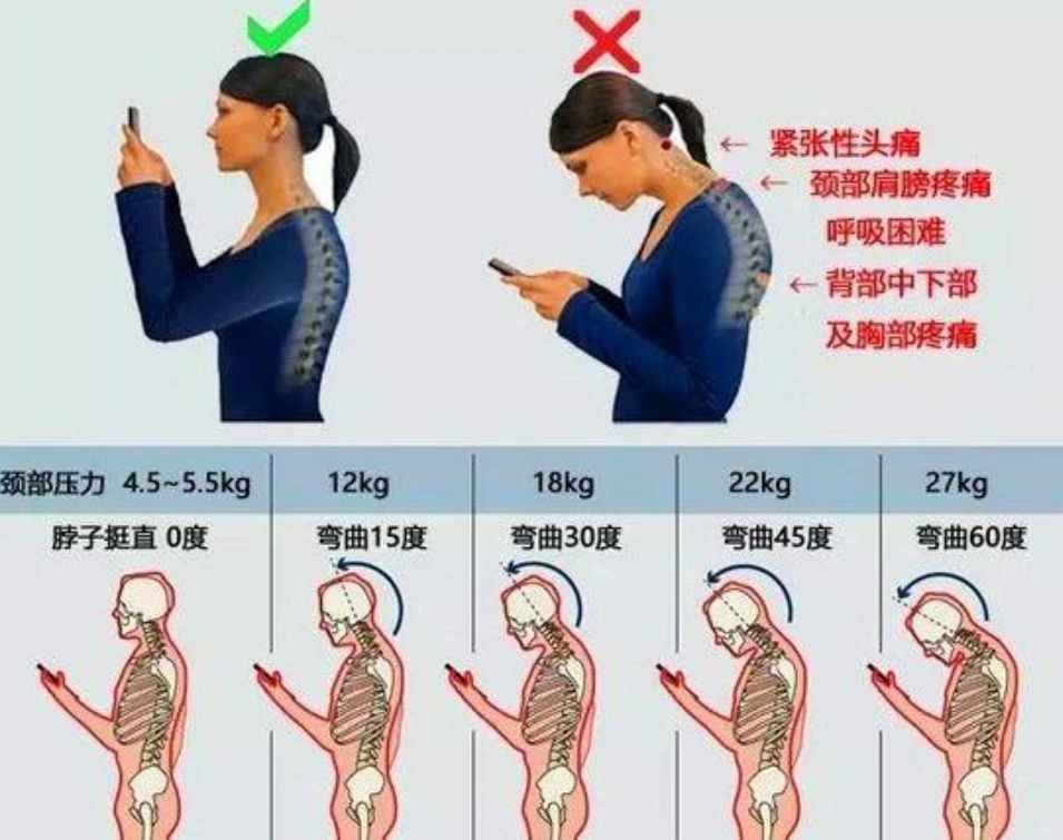 国庆长假刷手机悠着点！“低头族”的中医颈椎自救指南