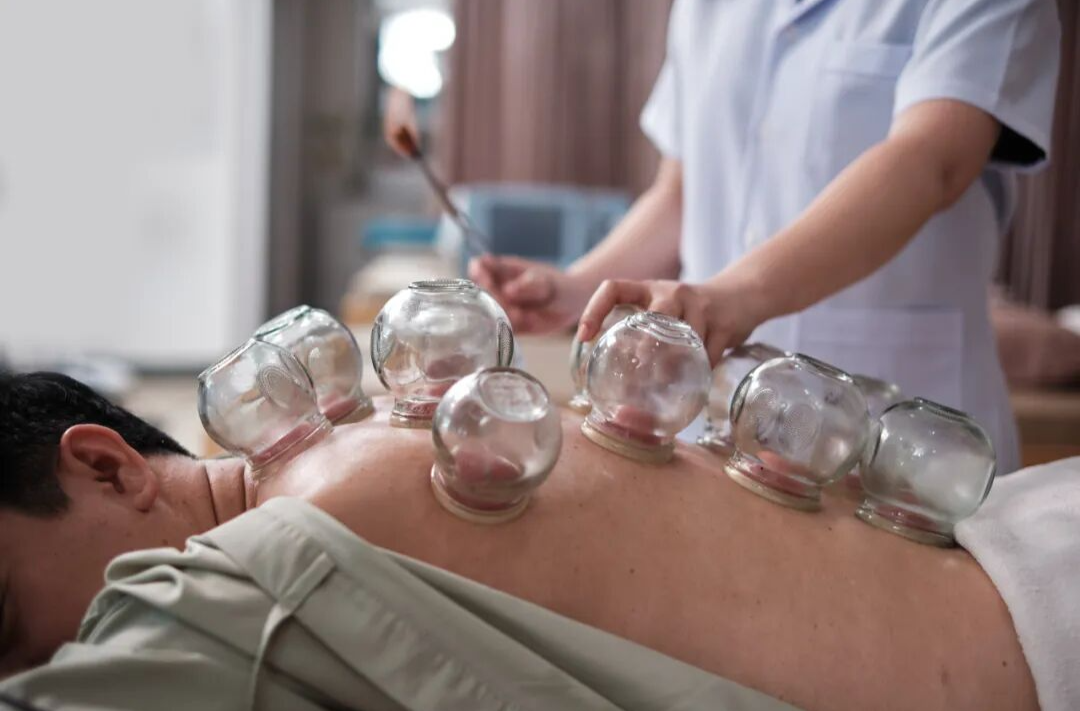 连拔2天火罐，突然高位截瘫！这5个拔罐误区要警惕！