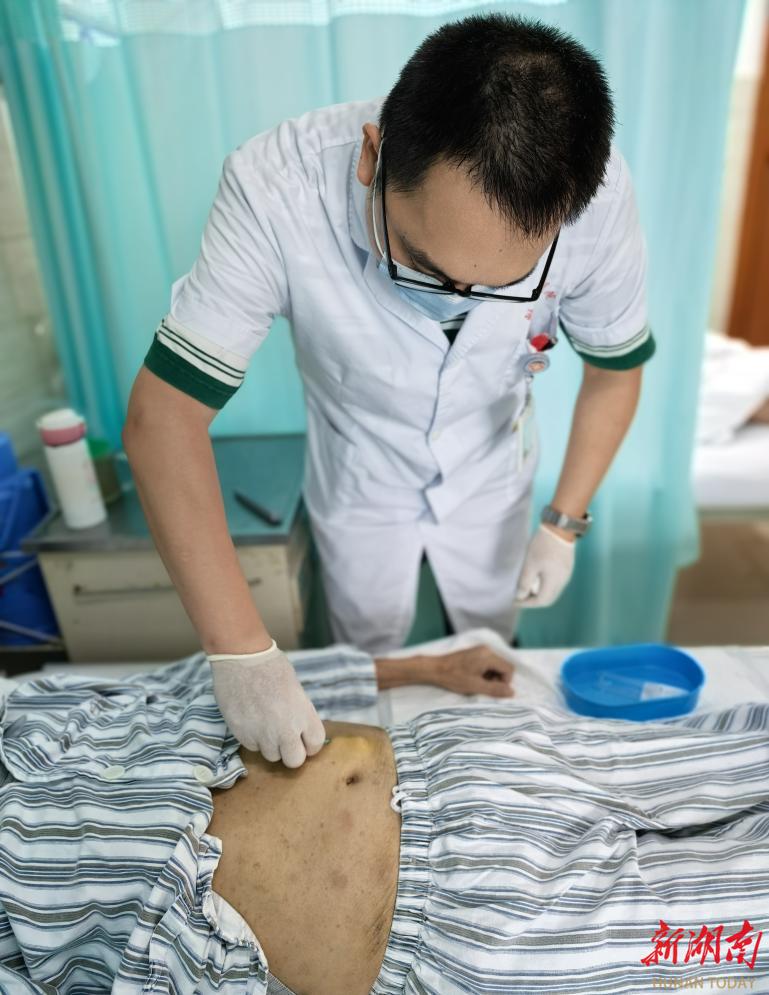 南华医院肛肠科浮针疗法解术后便秘之忧