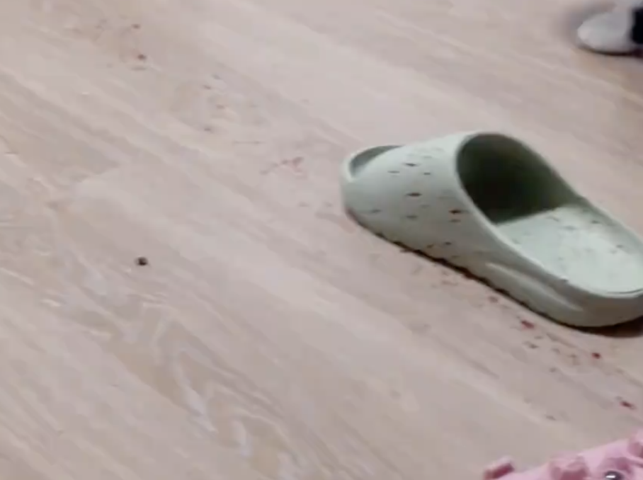 女子在家脚底突然喷血，紧急送医！这东西很多人在用