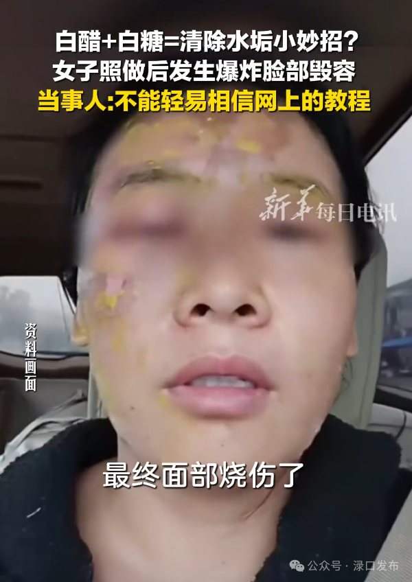 瞬间爆炸！女子用网传“生活妙招”险遭毁容！