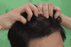 头上有这2种白发，必须排查疾病！很多人都不知道→