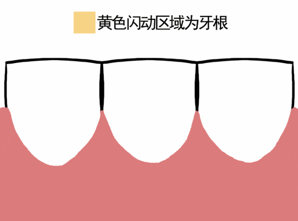 周末·健康丨牙龈萎缩了,还能再“长”回来吗?